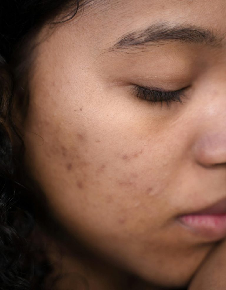 Extreme close-up of a woman's face showing skin imperfections and calm expression.